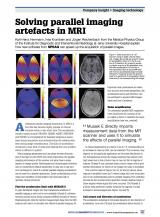 Medical Imaging Tech - Solving parallel imaging artifacts in MRI